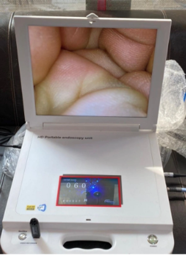 Genique Medicorp Endoscopy For OB/Gyn